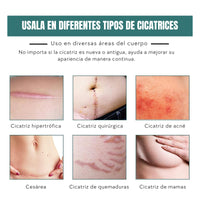 Zilva® Hojas de Silicona para Cicatrices y Arrugas x 3 Metros