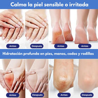 Avoléa® Crema Reparadora de Aguacate para Pies
