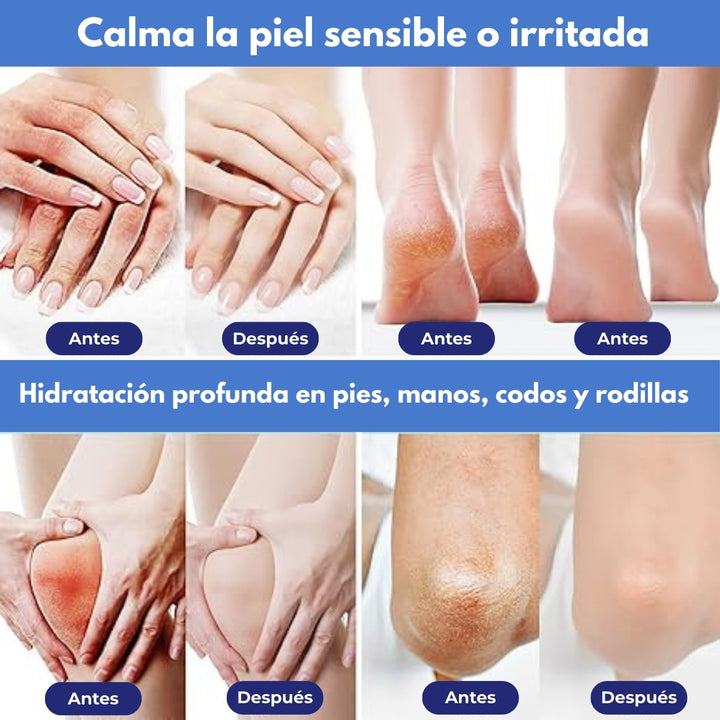 Avoléa® Crema Reparadora de Aguacate para Pies